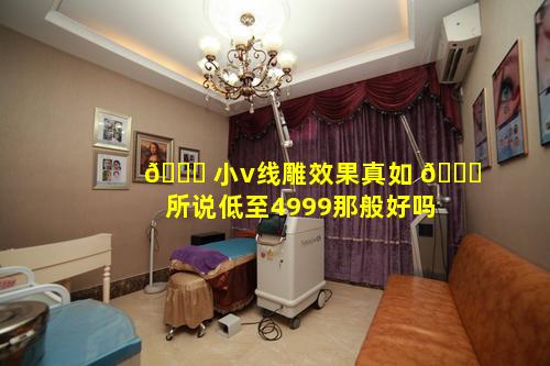 🐎 小v线雕效果真如 🐎 所说低至4999那般好吗